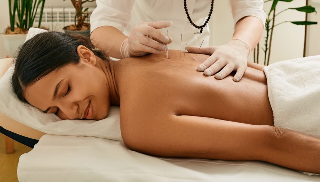 A licensed acupuncturist performing acupuncture therapy on a patient for chronic pain relief in Los Angeles.